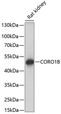 Western blot - CORO1B antibody (A14593)