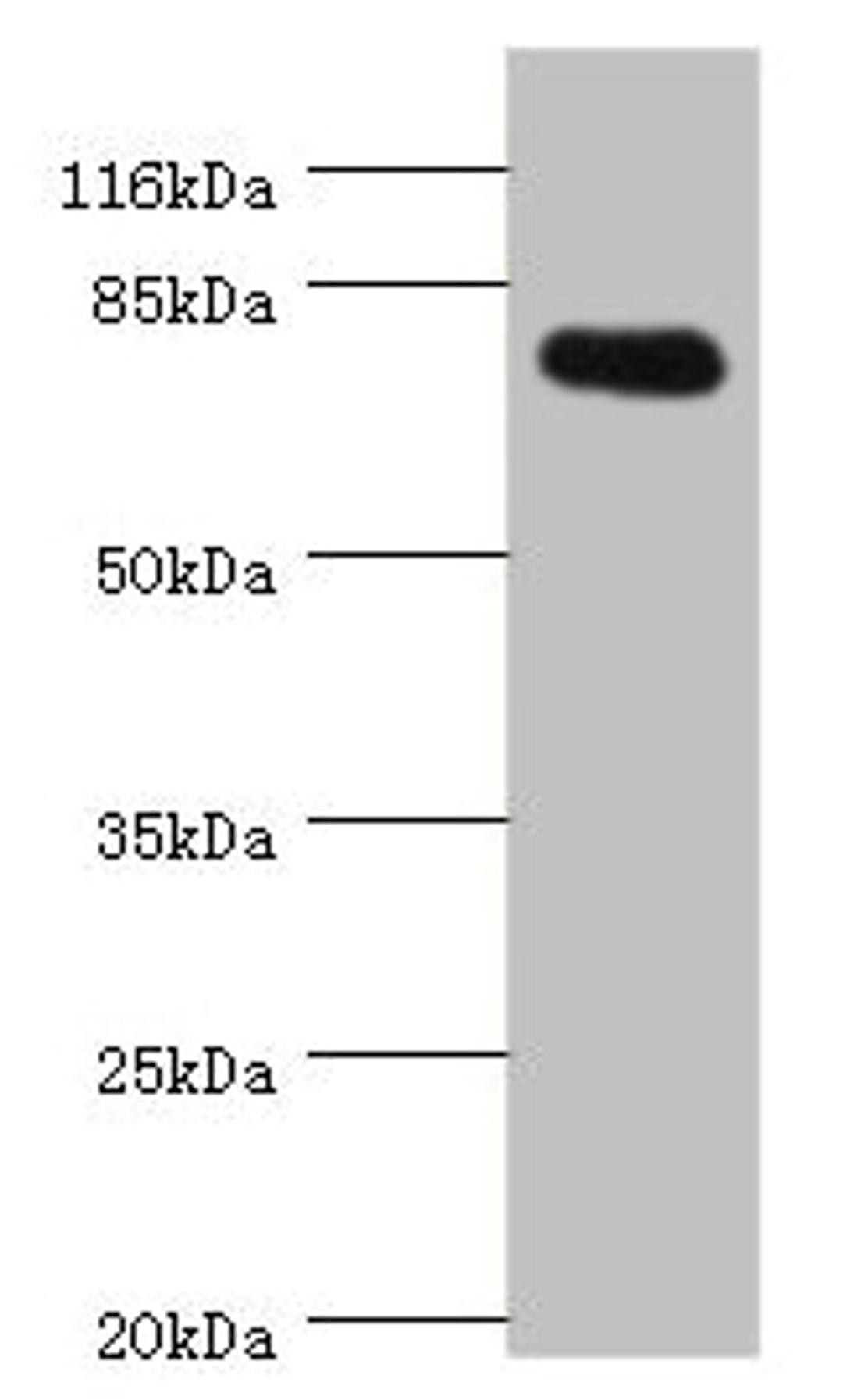 Western blot. All lanes: SH2B1 antibody at 0.81ug/ml + 293T whole cell lysate. Secondary. Goat polyclonal to rabbit IgG at 1/10000 dilution. Predicted band size: 80, 71, 73 kDa. Observed band size: 80 kDa. 