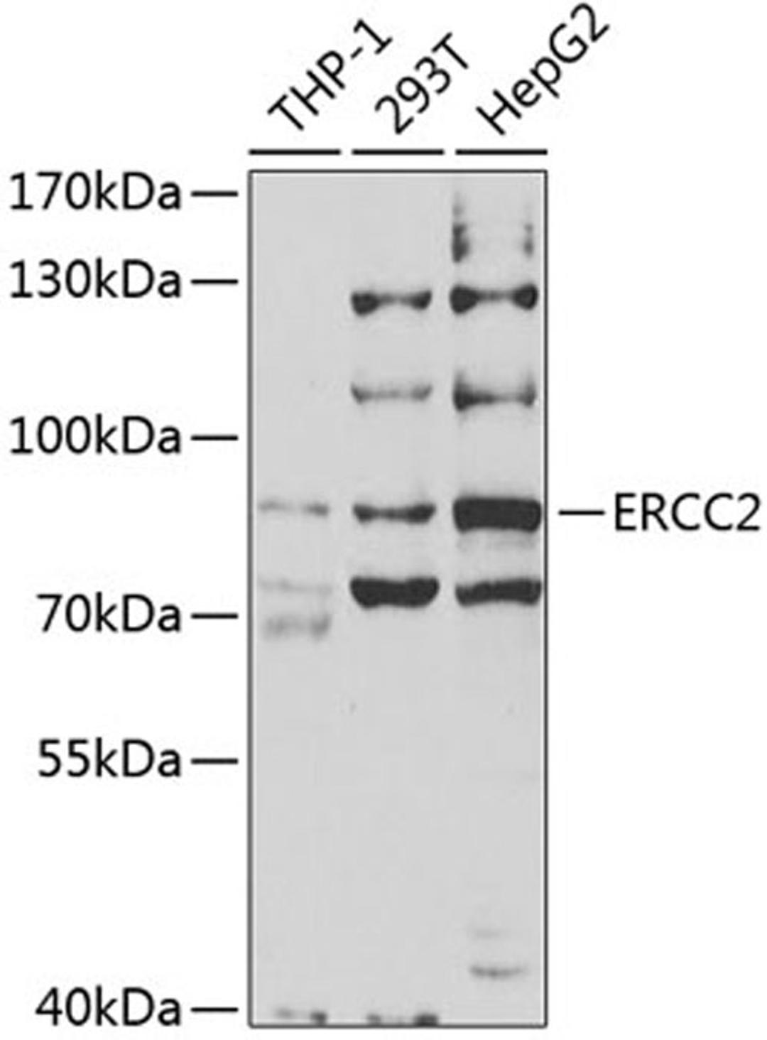 Western blot - ERCC2 antibody (A5640)