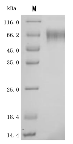 (Tris-Glycine gel) Discontinuous SDS-PAGE (reduced) with 5% enrichment gel and 15% separation gel.