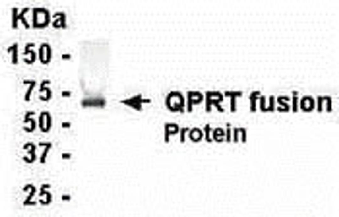 E coli-derived fusion protein as test antigen. Affinity-purified IgY dilution: 1:2000, Goat anti-IgY-HRP dilution: 1:1000. Colorimetric method for signal development.