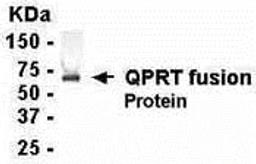 E coli-derived fusion protein as test antigen. Affinity-purified IgY dilution: 1:2000, Goat anti-IgY-HRP dilution: 1:1000. Colorimetric method for signal development.