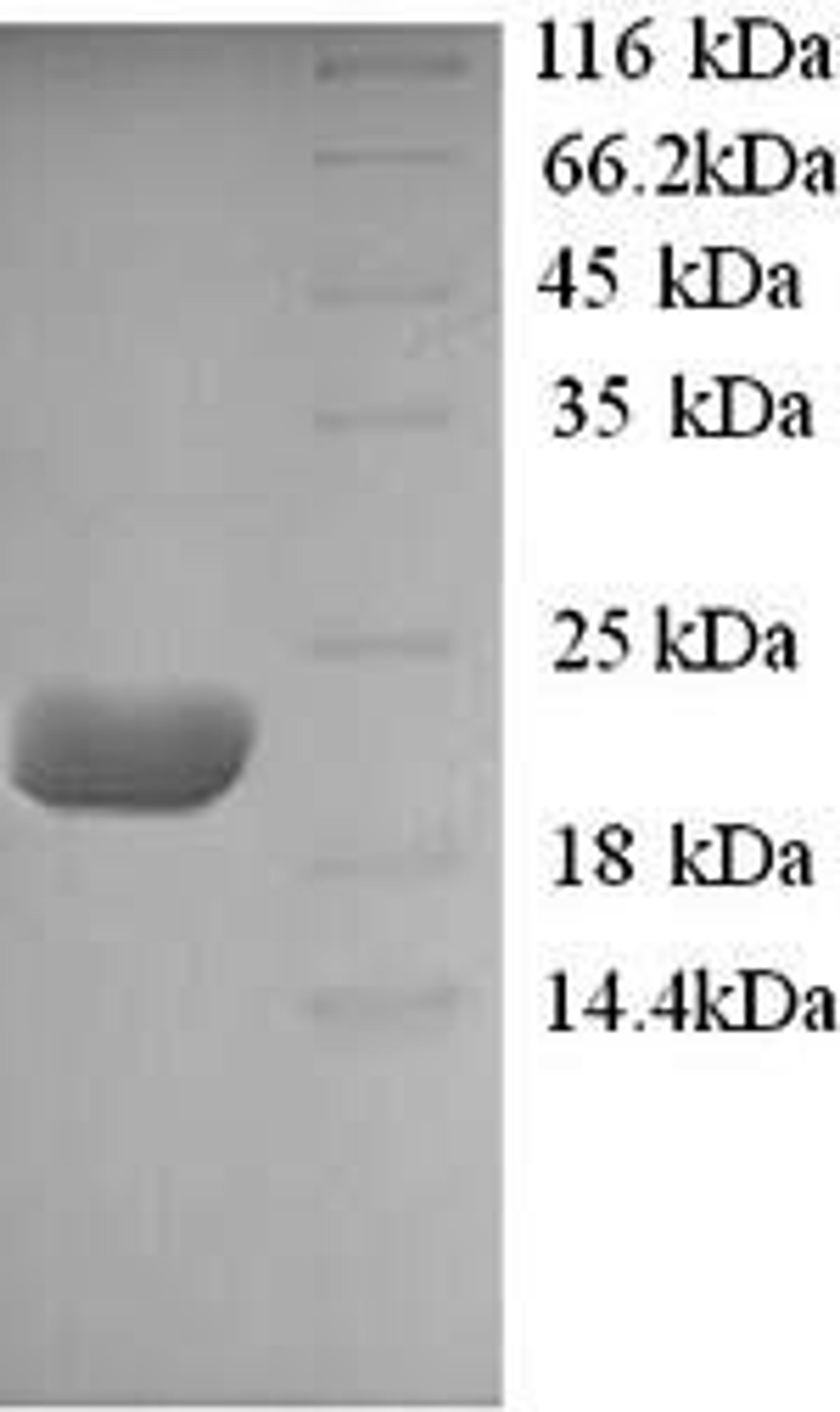 (Tris-Glycine gel) Discontinuous SDS-PAGE (reduced) with 5% enrichment gel and 15% separation gel.