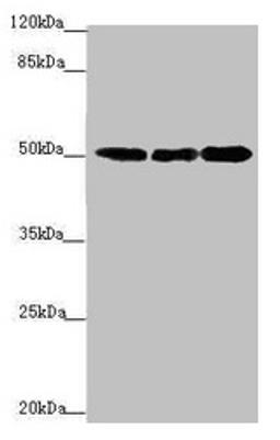 Western blot. All lanes: EEF1A2 antibody at 2.23µg/ml. Lane 1: MCF-7 whole cell lysate. Lane 2: Hela whole cell lysate. Lane 3: Raji whole cell lysate. Secondary. Goat polyclonal to rabbit IgG at 1/10000 dilution. Predicted band size: 50 kDa. Observed band size: 50 kDa