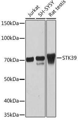 Western blot - STK39 Rabbit mAb (A2275)