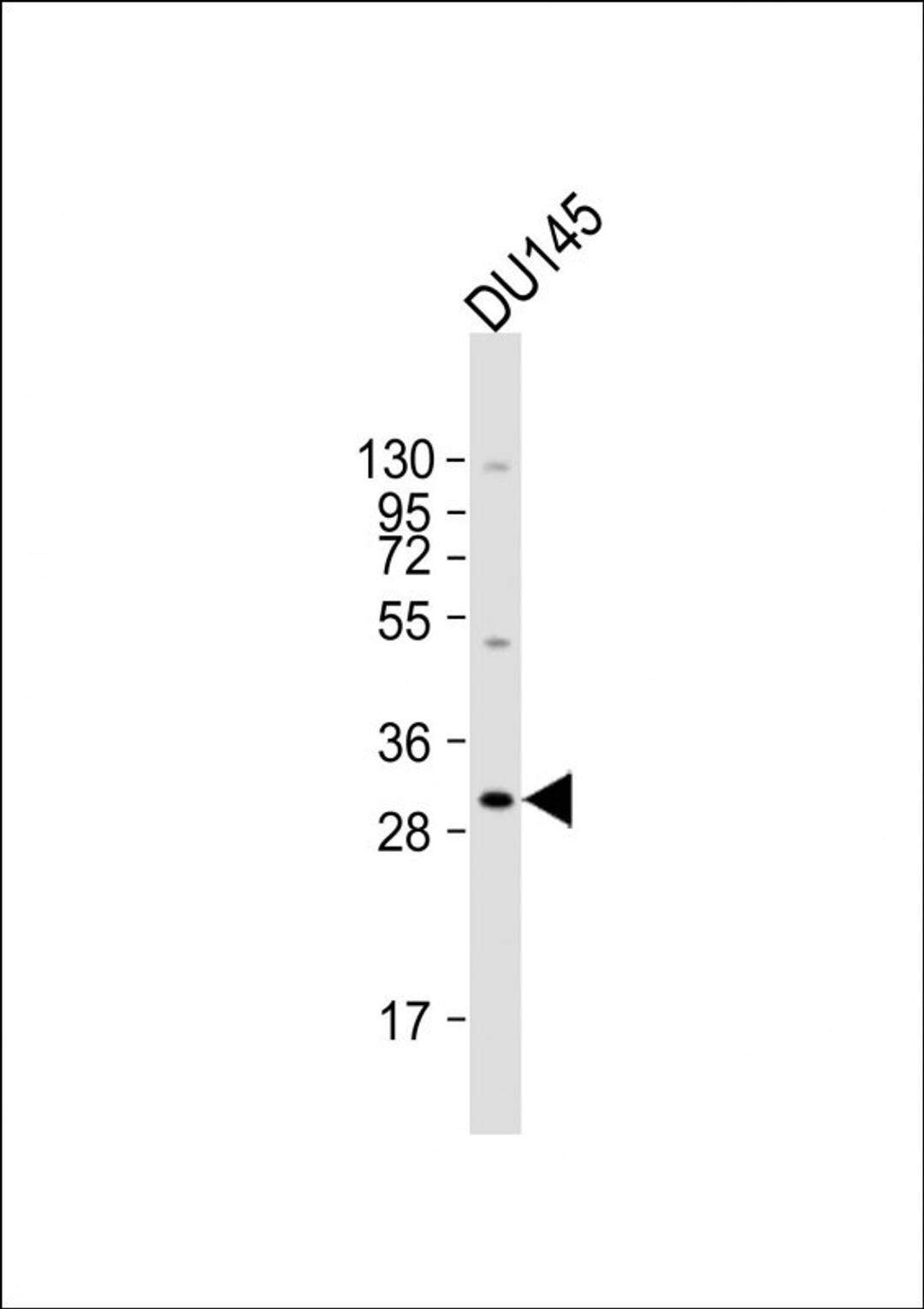 Western Blot at 1:2000 dilution + DU145 whole cell lysate Lysates/proteins at 20 ug per lane.