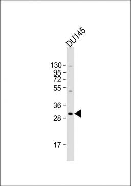 Western Blot at 1:2000 dilution + DU145 whole cell lysate Lysates/proteins at 20 ug per lane.