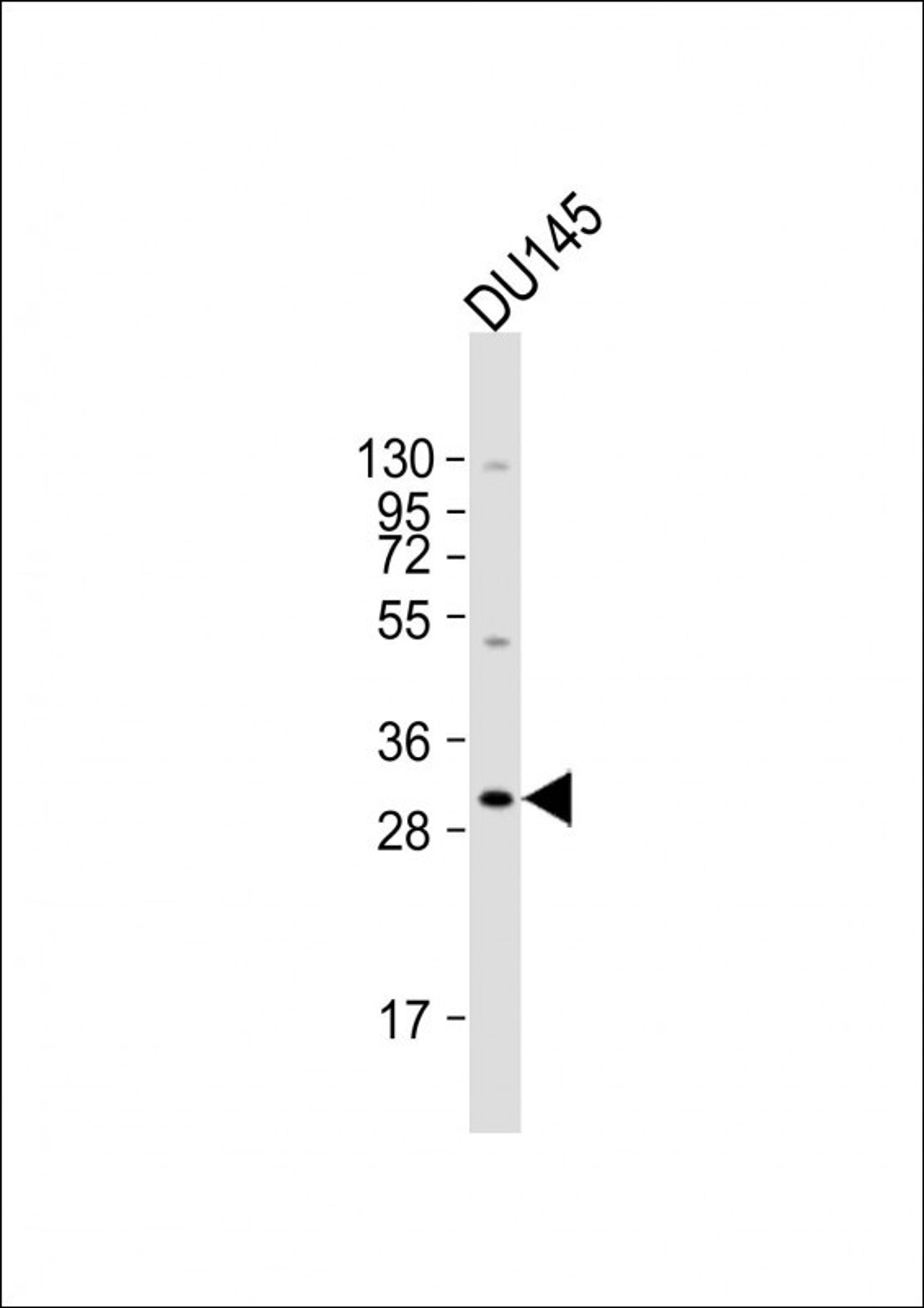 Western Blot at 1:2000 dilution + DU145 whole cell lysate Lysates/proteins at 20 ug per lane.