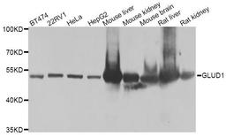 Western blot analysis of extracts of various cell lines using GLUD1 antibody