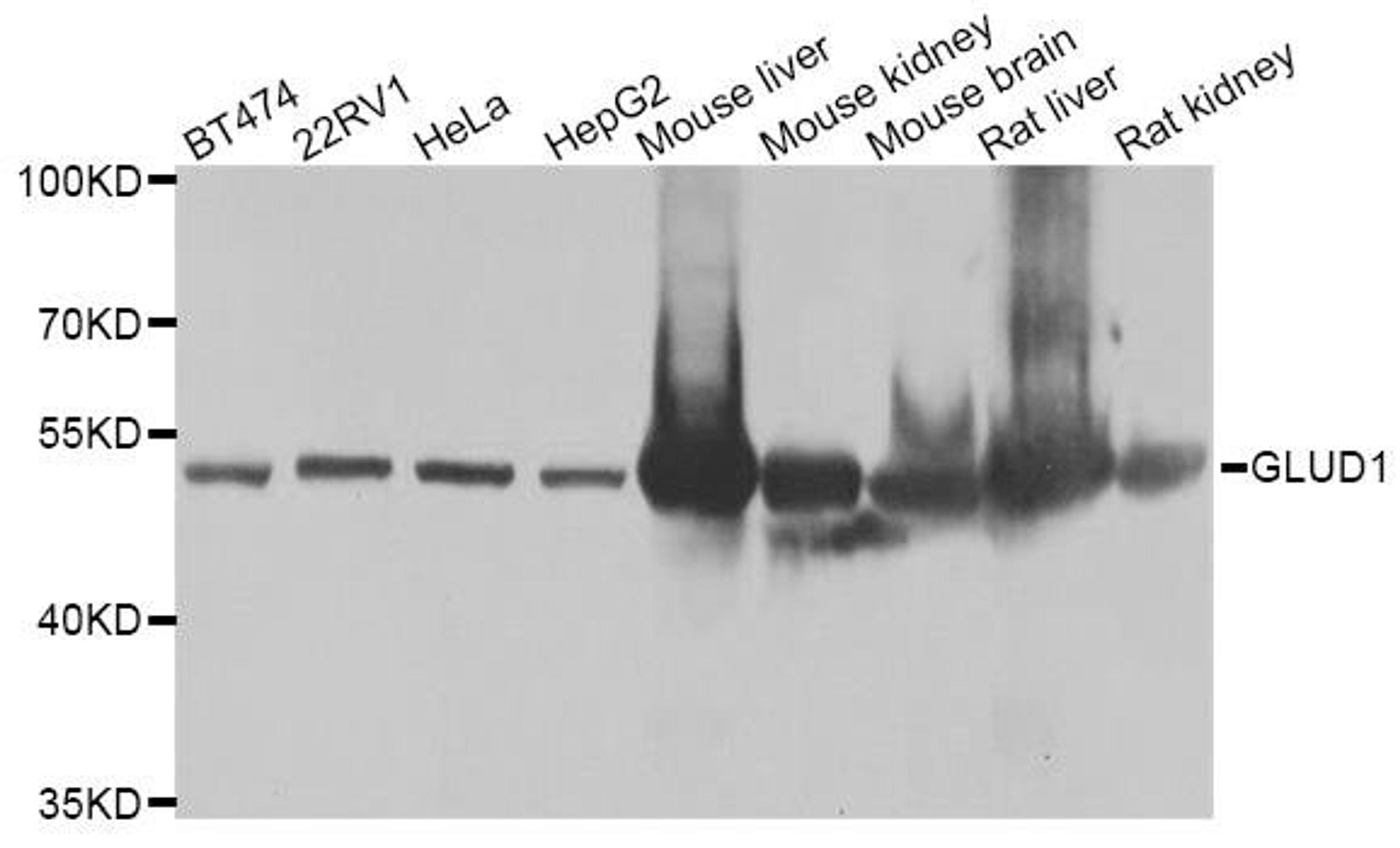 Western blot analysis of extracts of various cell lines using GLUD1 antibody