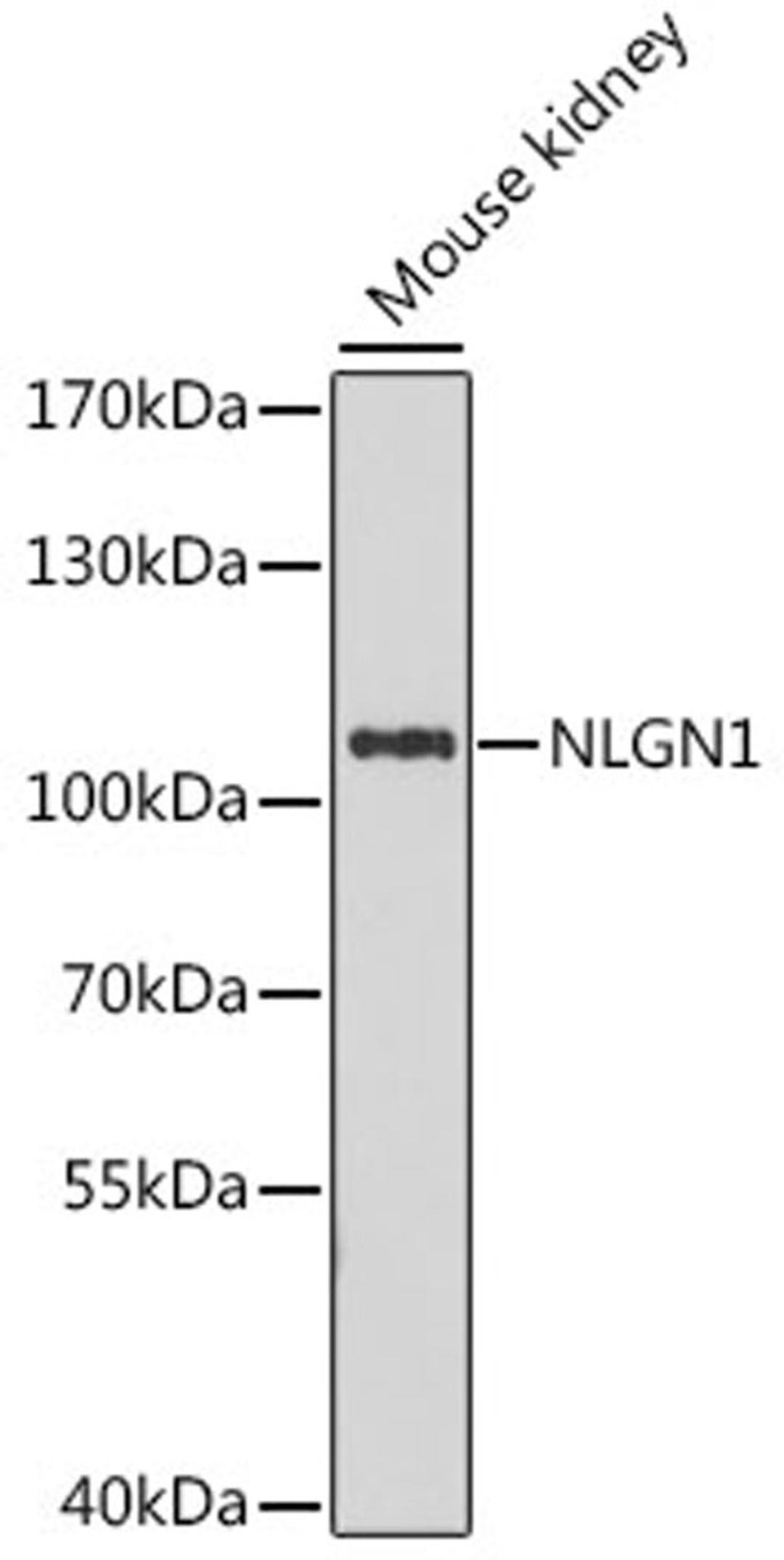 Western blot - NLGN1 antibody (A16105)