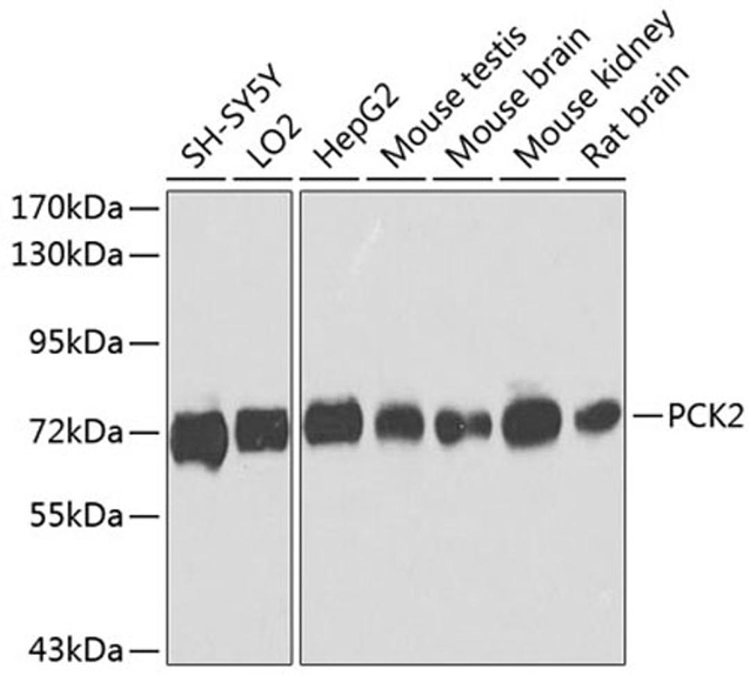 Western blot - PCK2 antibody (A8446)