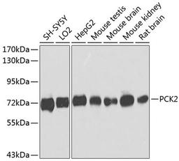 Western blot - PCK2 antibody (A8446)