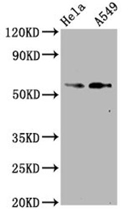 Western Blot. Positive WB detected in Hela whole cell lysate,A549 whole cell lysate. All lanes Phospho-SMAD2 antibody at 1.07μg/ml. Secondary. Goat polyclonal to rabbit IgG at 1/50000 dilution. Predicted band size: 58 KDa. Observed band size: 58 KDa. 