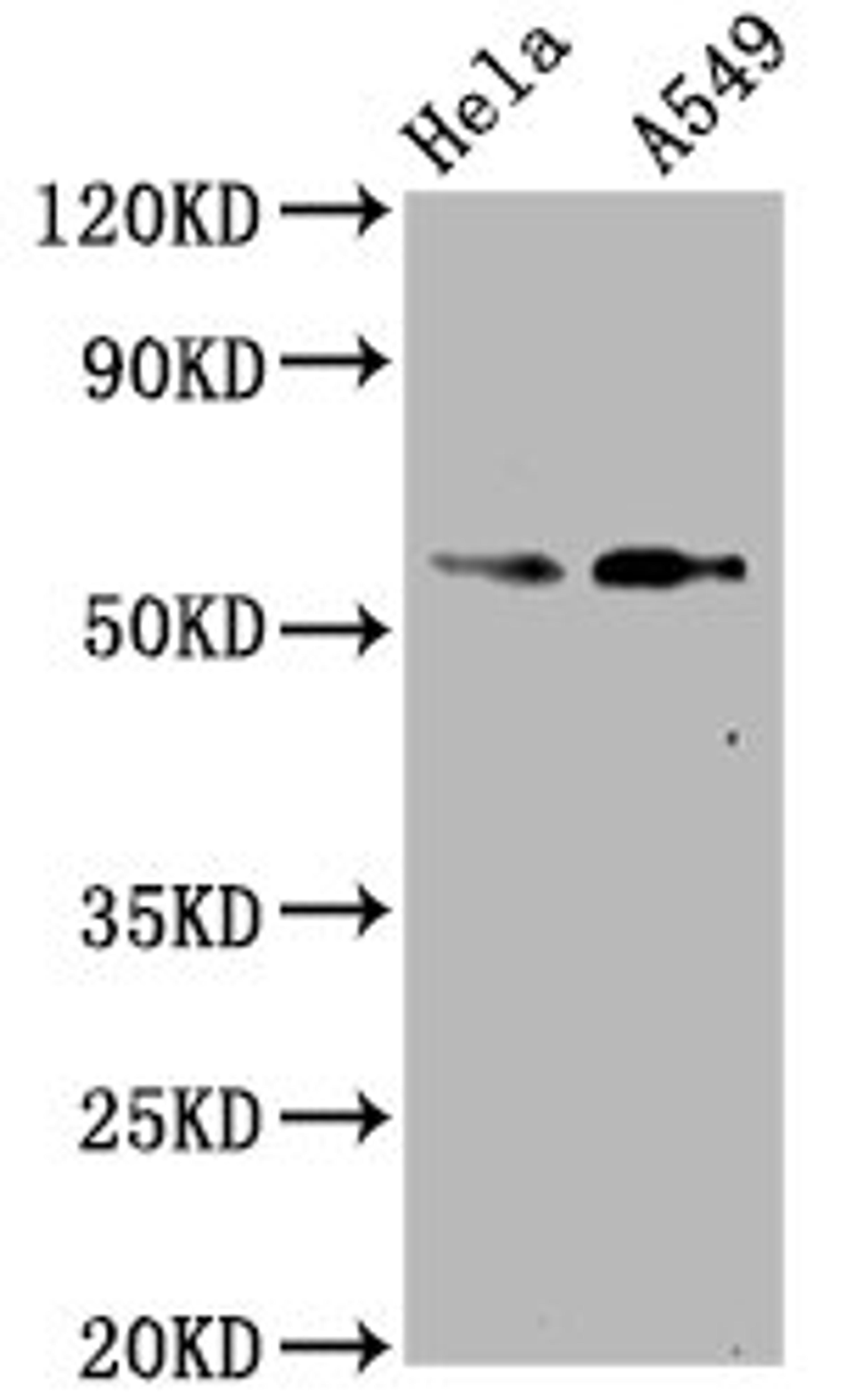 Western Blot. Positive WB detected in Hela whole cell lysate,A549 whole cell lysate. All lanes Phospho-SMAD2 antibody at 1.07μg/ml. Secondary. Goat polyclonal to rabbit IgG at 1/50000 dilution. Predicted band size: 58 KDa. Observed band size: 58 KDa. 