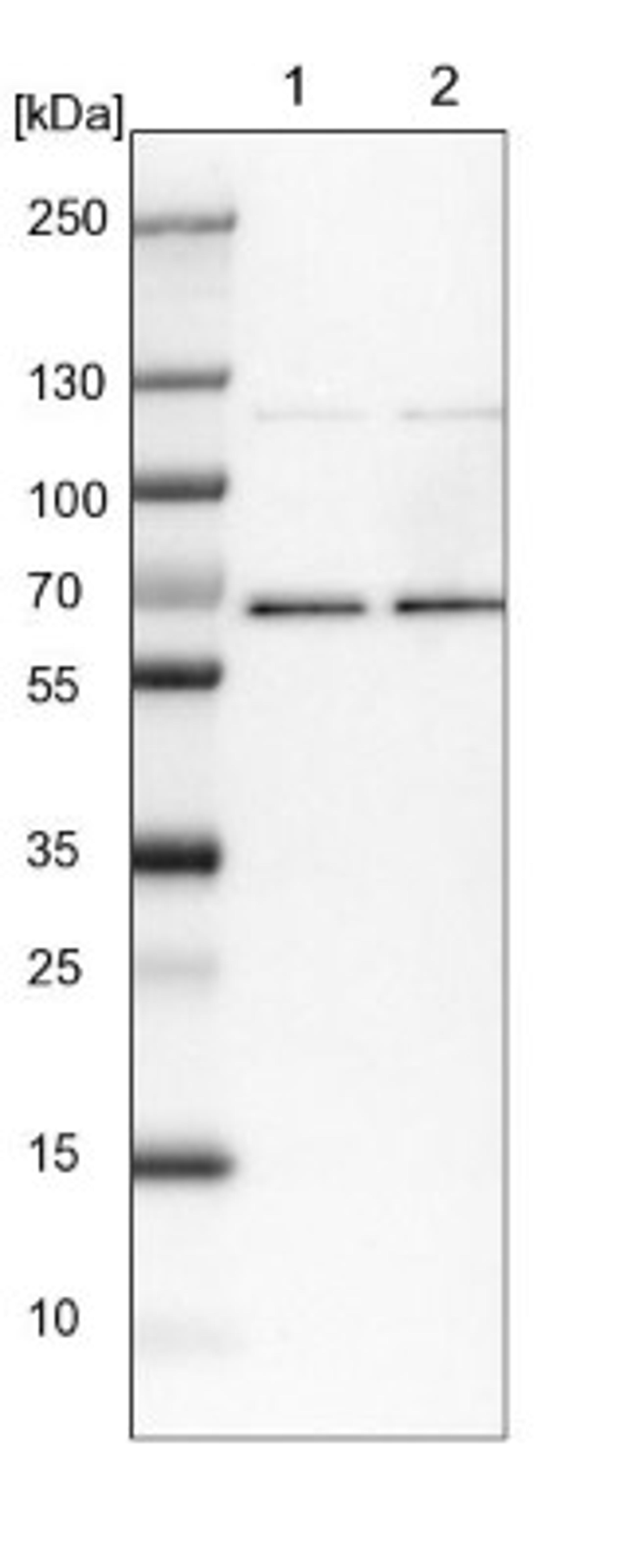 Western Blot: POLR3E Antibody [NBP1-84621] - Lane 1: NIH-3T3 cell lysate (Mouse embryonic fibroblast cells)<br/>Lane 2: NBT-II cell lysate (Rat Wistar bladder tumour cells)