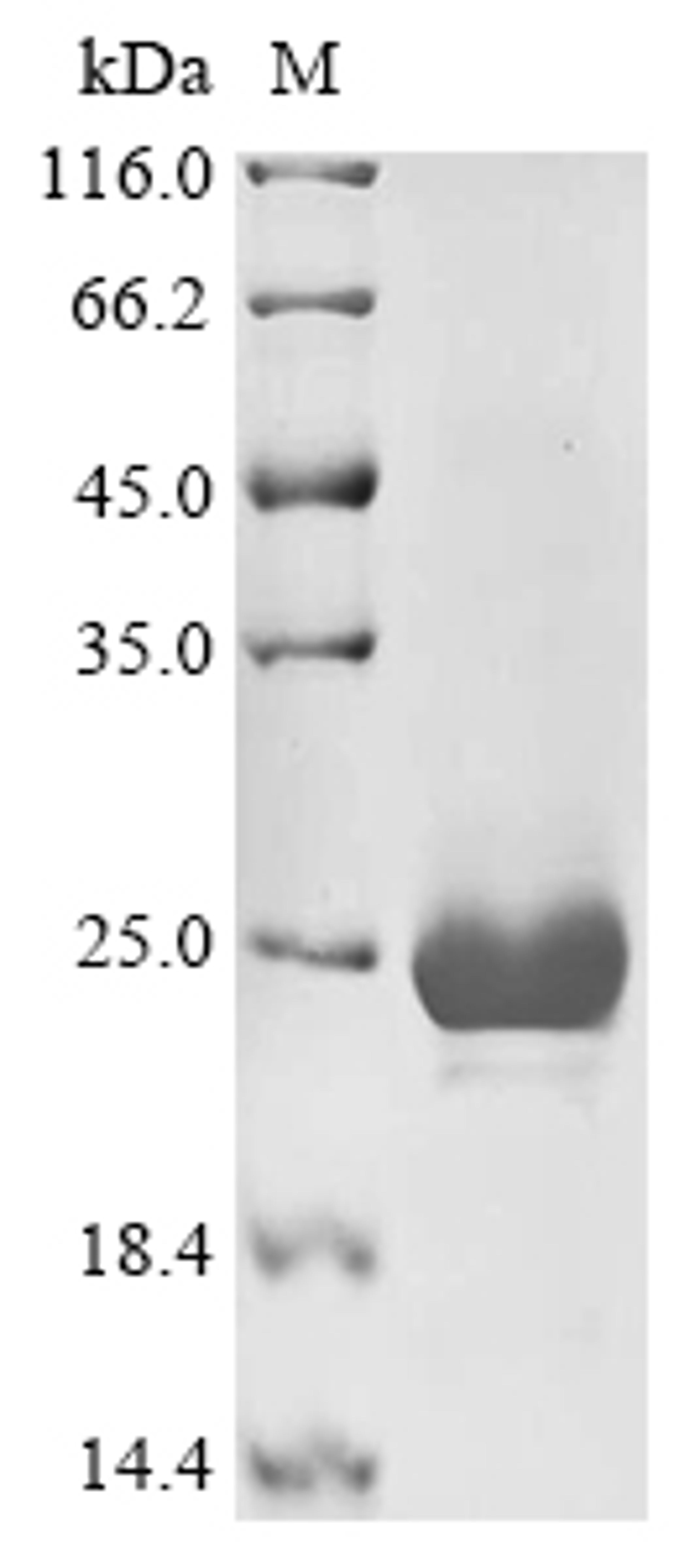 (Tris-Glycine gel) Discontinuous SDS-PAGE (reduced) with 5% enrichment gel and 15% separation gel.