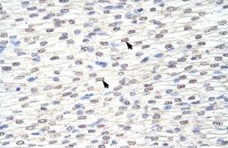 Immunohistochemistry-Paraffin: GRHL3 Antibody [NBP1-80356] - Human Heart Tissue, antibody concentration 4-8ug/ml. Cells with positive label: Myocardial cells (indicated with arrows) 400X magnification.