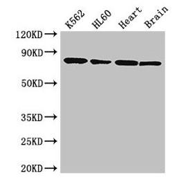 Western Blot. Positive WB detected in: K562 whole cell lysate, HL60 whole cell lysate, Mouse heart tissue, Mouse brain tissue. All lanes: BTK antibody at 3.5µg/ml. Secondary. Goat polyclonal to rabbit IgG at 1/50000 dilution. Predicted band size: 77, 80 kDa. Observed band size: 77 kDa