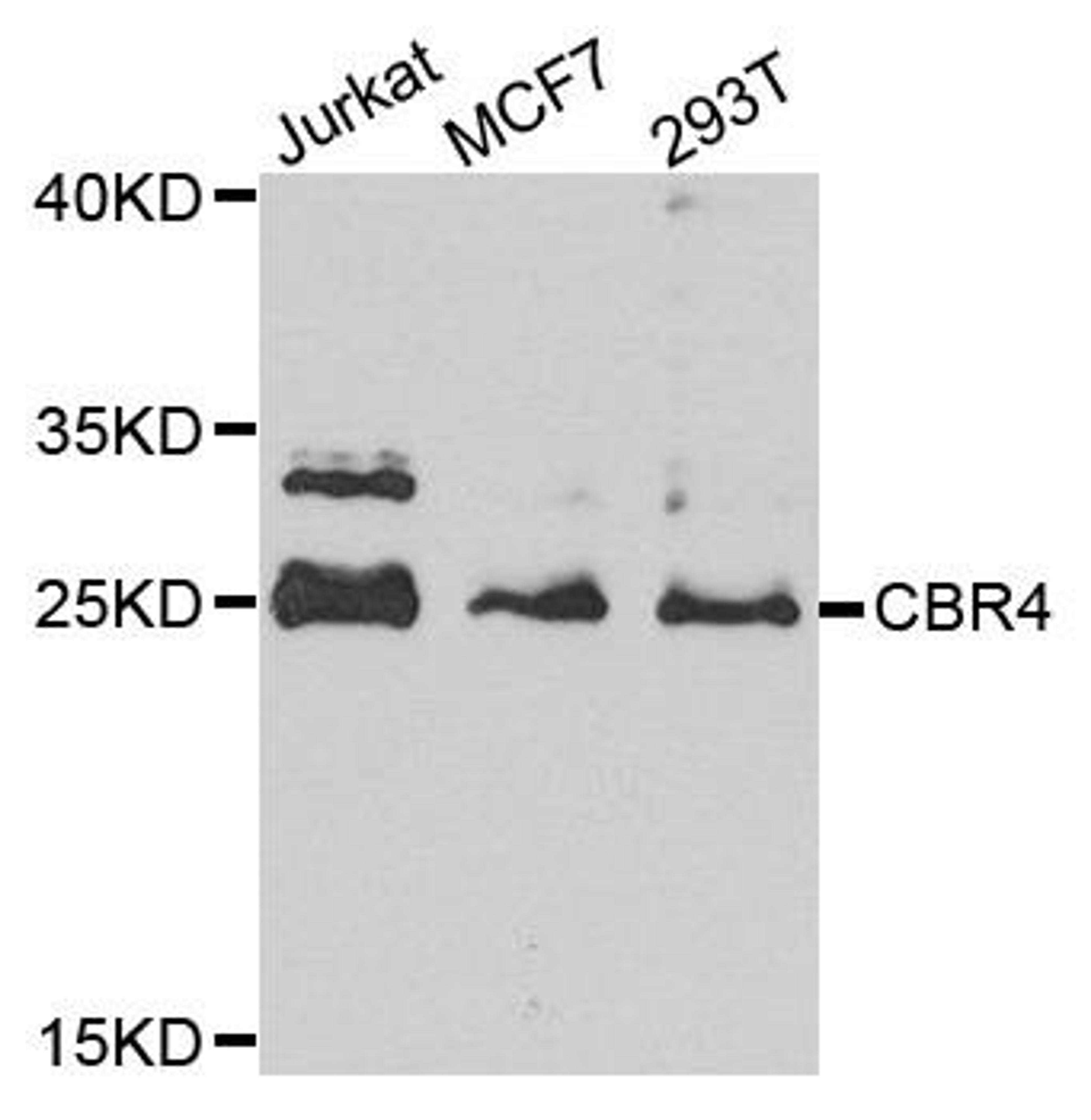 Western blot analysis of extract of various cells using CBR4 antibody