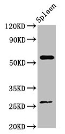 Western Blot. Positive WB detected in: Mouse spleen tissue. All lanes: ACD antibody at 4ug/ml. Secondary. Goat polyclonal to rabbit IgG at 1/50000 dilution. Predicted band size: 58 kDa. Observed band size: 58 kDa.