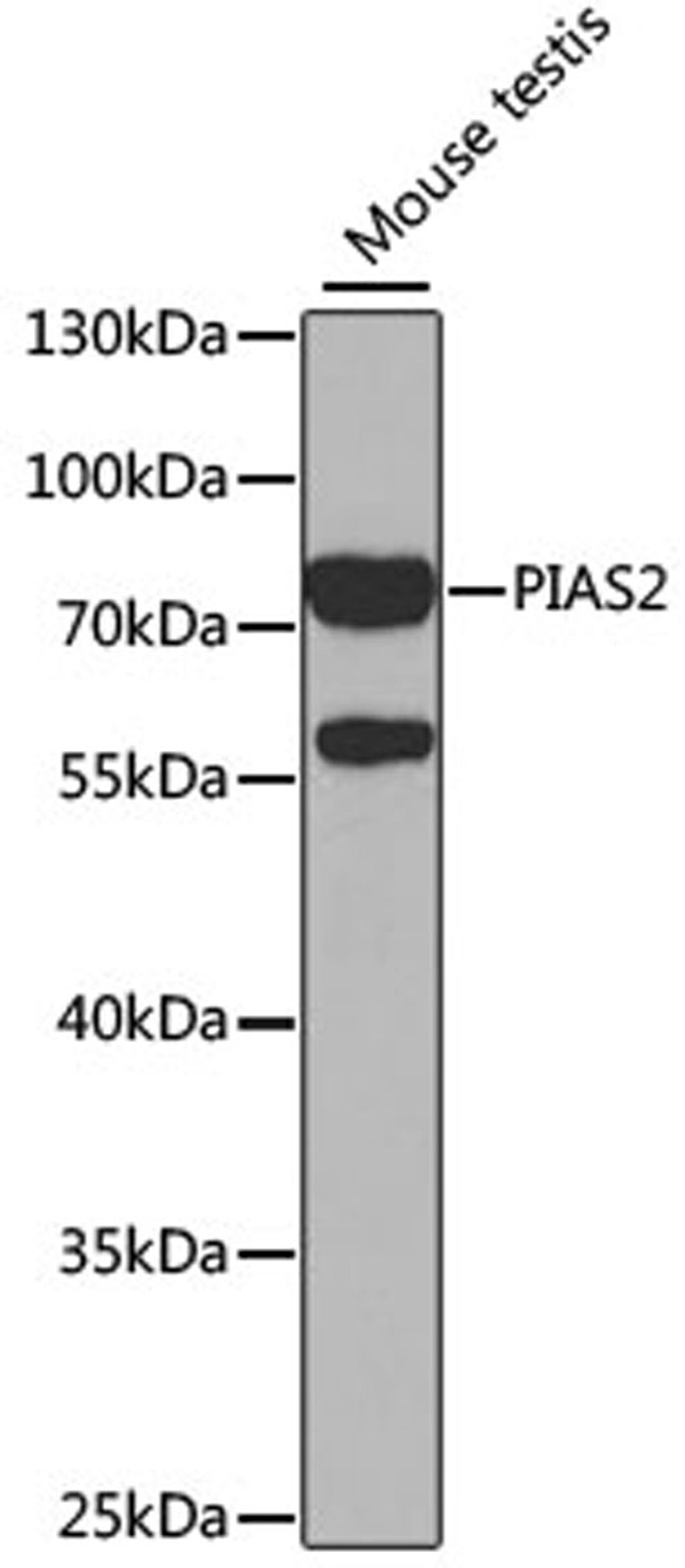 Western blot - PIAS2 antibody (A5654)