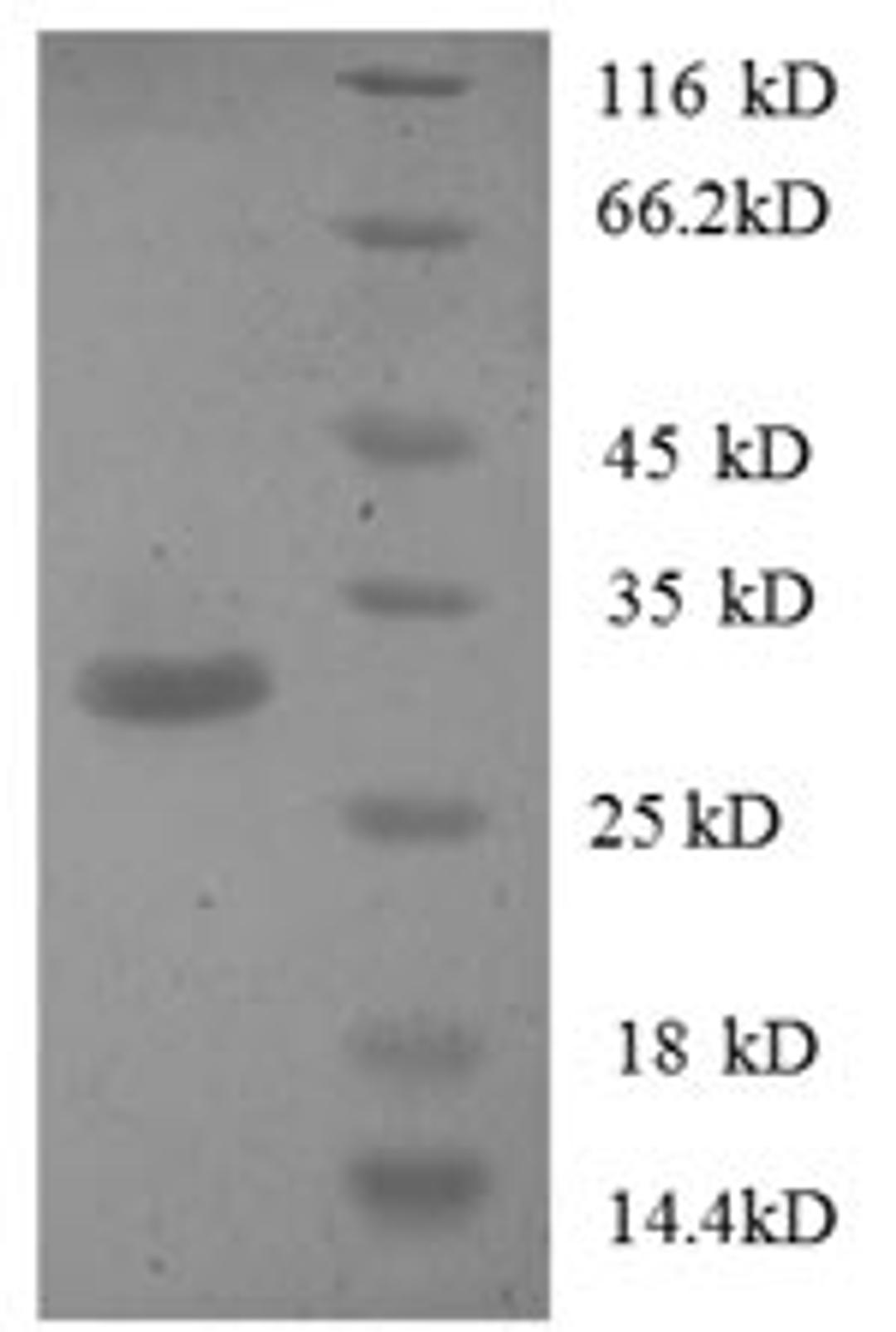 (Tris-Glycine gel) Discontinuous SDS-PAGE (reduced) with 5% enrichment gel and 15% separation gel.