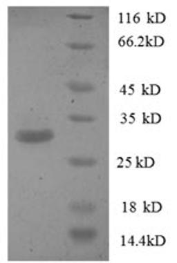 (Tris-Glycine gel) Discontinuous SDS-PAGE (reduced) with 5% enrichment gel and 15% separation gel.