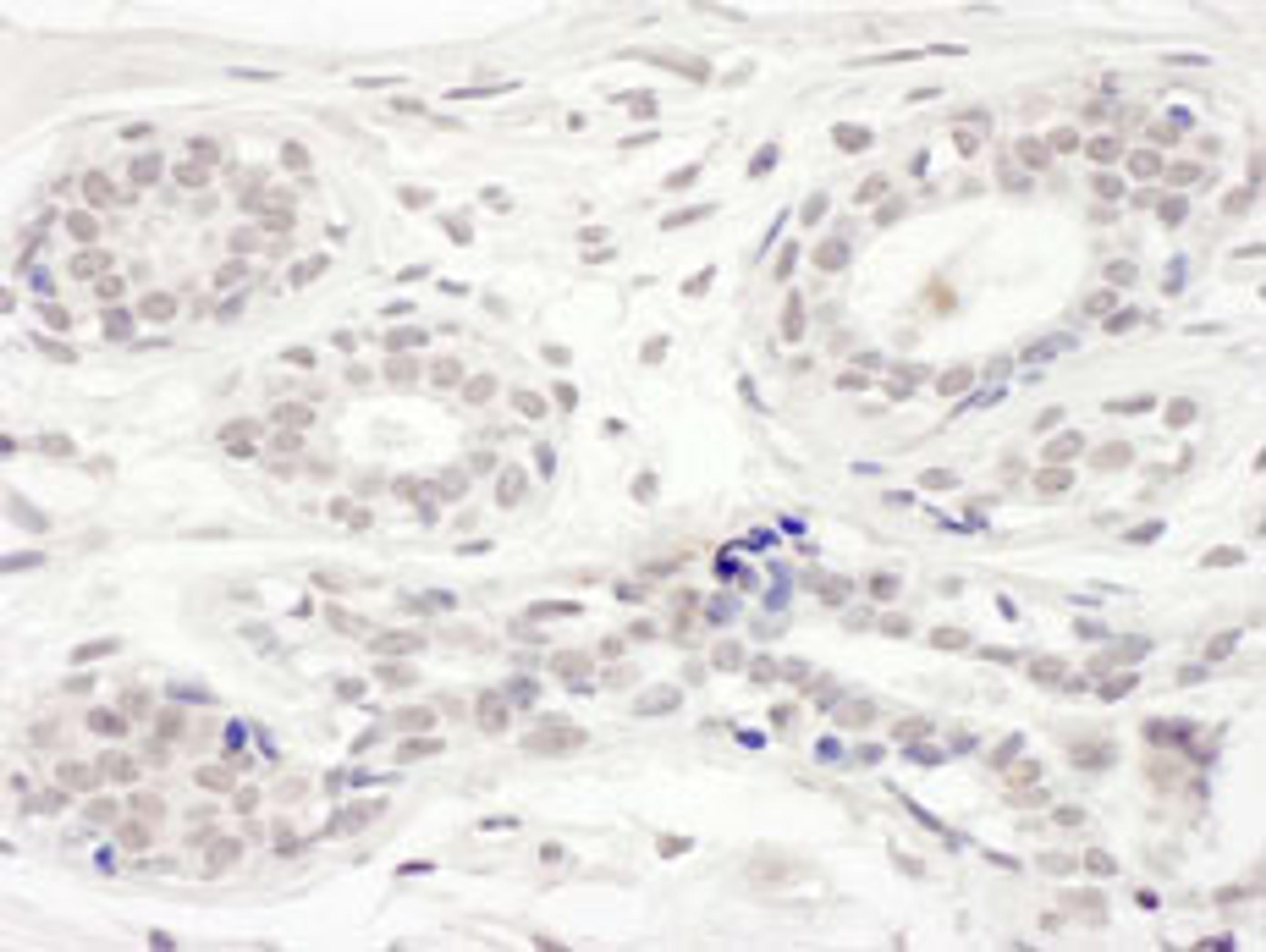 Detection of human BRD8 by immunohistochemistry.