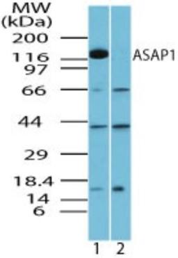 Western Blot: ASAP1 Antibody [NBP2-24643] - Analysis of ASAP1 in mouse brain lysate in the 1) absence and 2) presence of immunizing peptide using NBP2-24643 at 2.0 ug/ml. Goat anti-rabbit Ig HRP secondary antibody and PicoTect ECL substrate solution were used for this test.