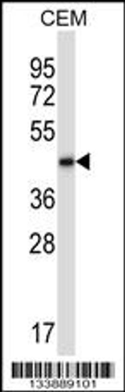 Western blot analysis in CEM cell line lysates (35ug/lane).