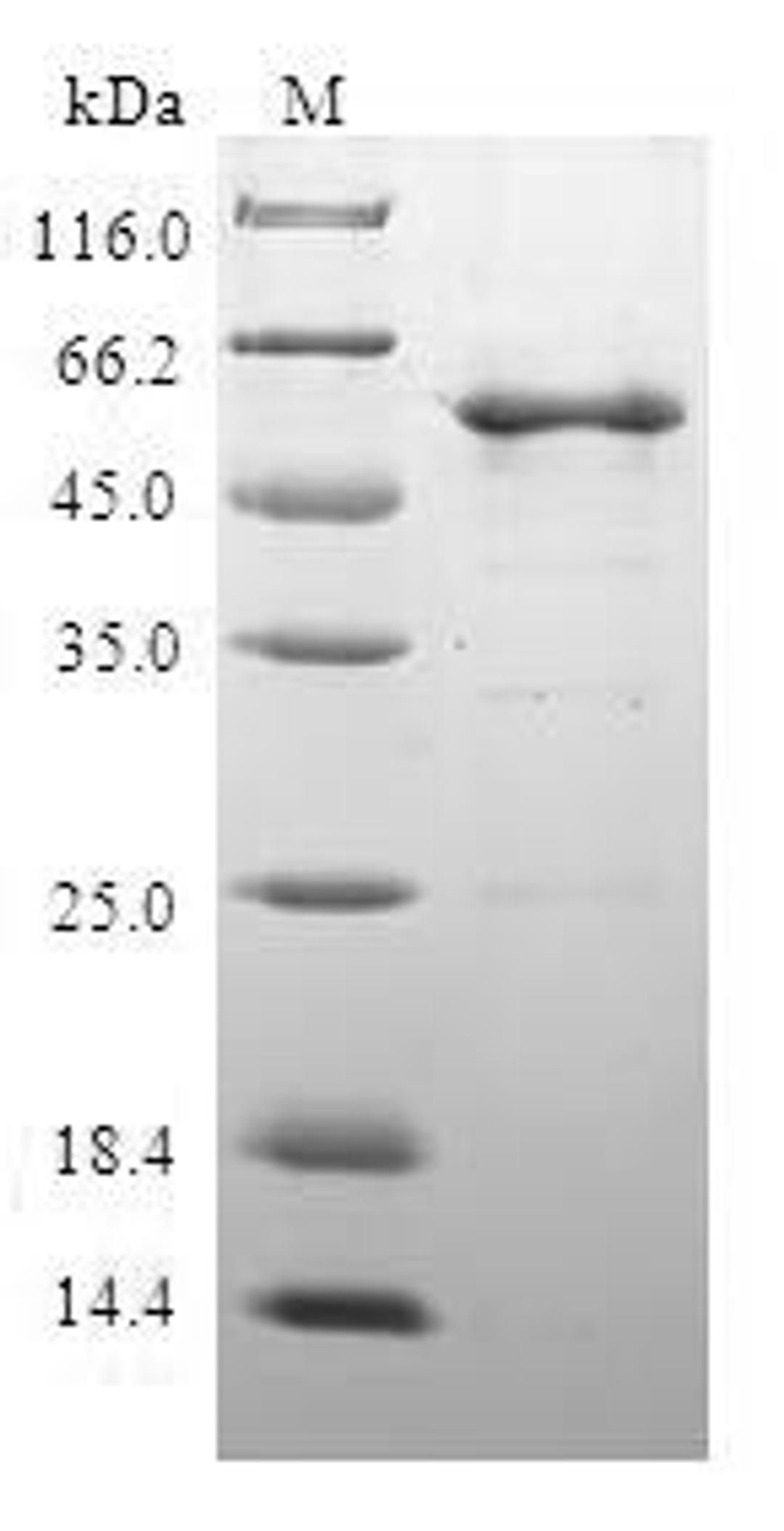 (Tris-Glycine gel) Discontinuous SDS-PAGE (reduced) with 5% enrichment gel and 15% separation gel.