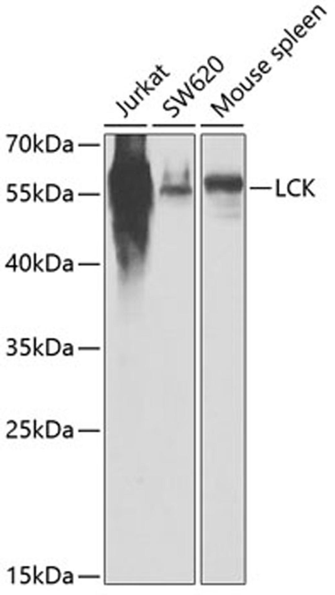 Western blot - LCK antibody (A2177)