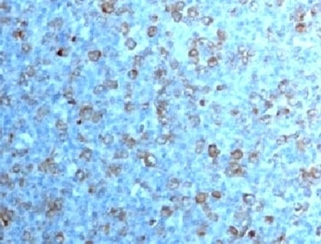 IHC testing of formalin-fixed, paraffin-embedded human tonsil with Cdc2 antibody (CDK1/873).