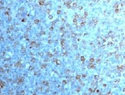 IHC testing of formalin-fixed, paraffin-embedded human tonsil with Cdc2 antibody (CDK1/873).