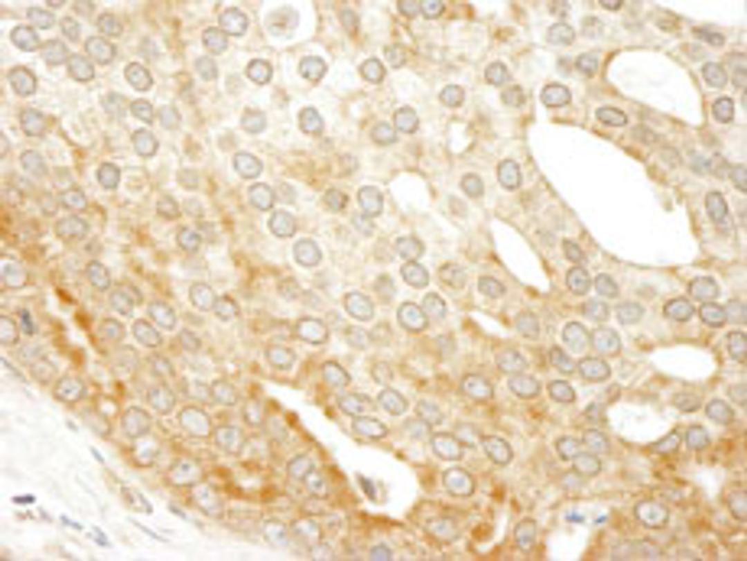 Detection of human ABC50 by immunohistochemistry.