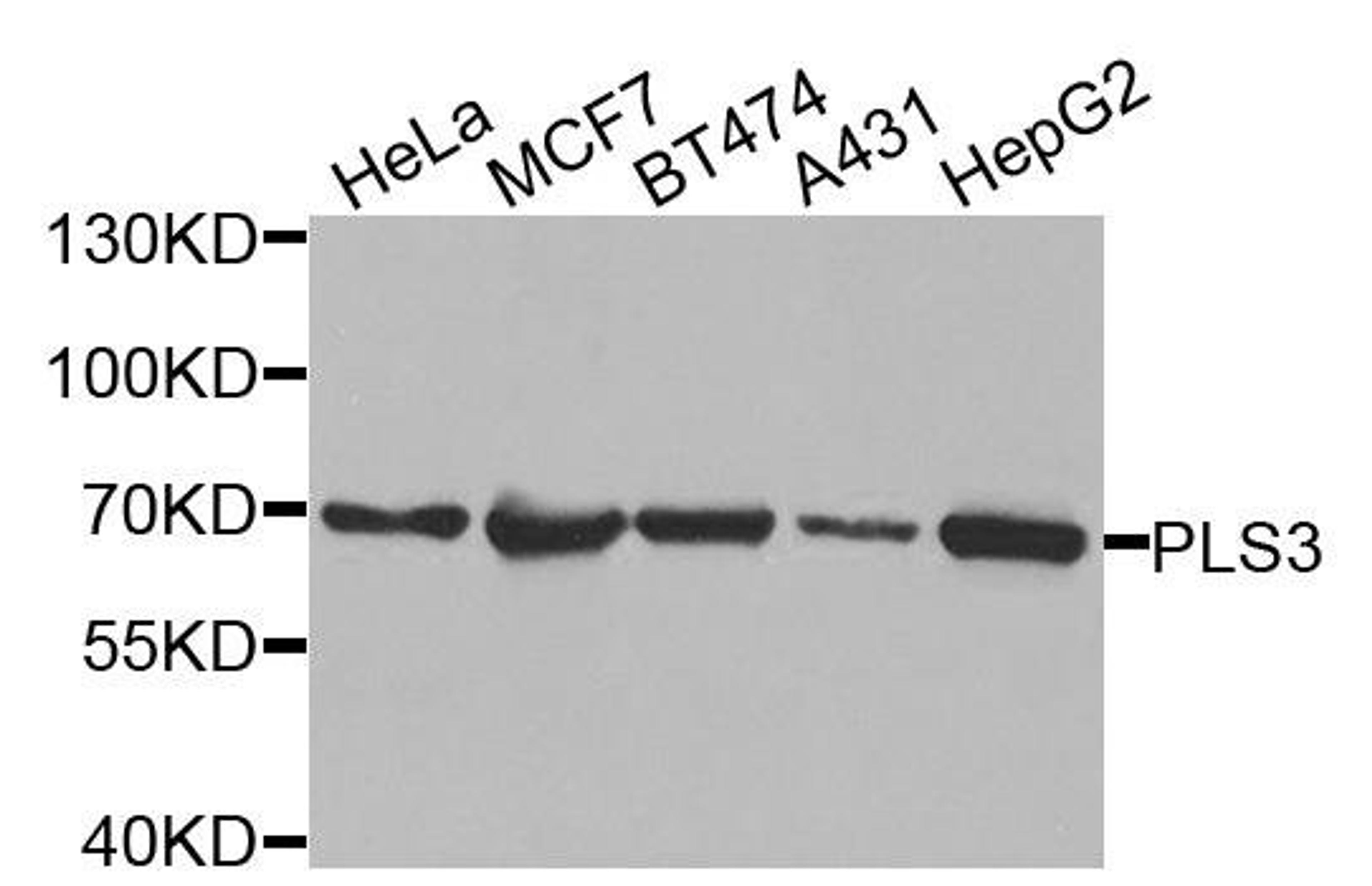 Western blot analysis of extracts of various cells using PLS3 antibody