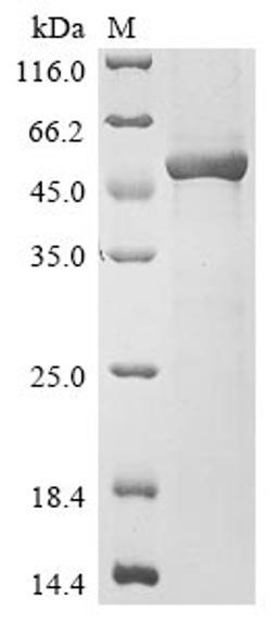 (Tris-Glycine gel) Discontinuous SDS-PAGE (reduced) with 5% enrichment gel and 15% separation gel.