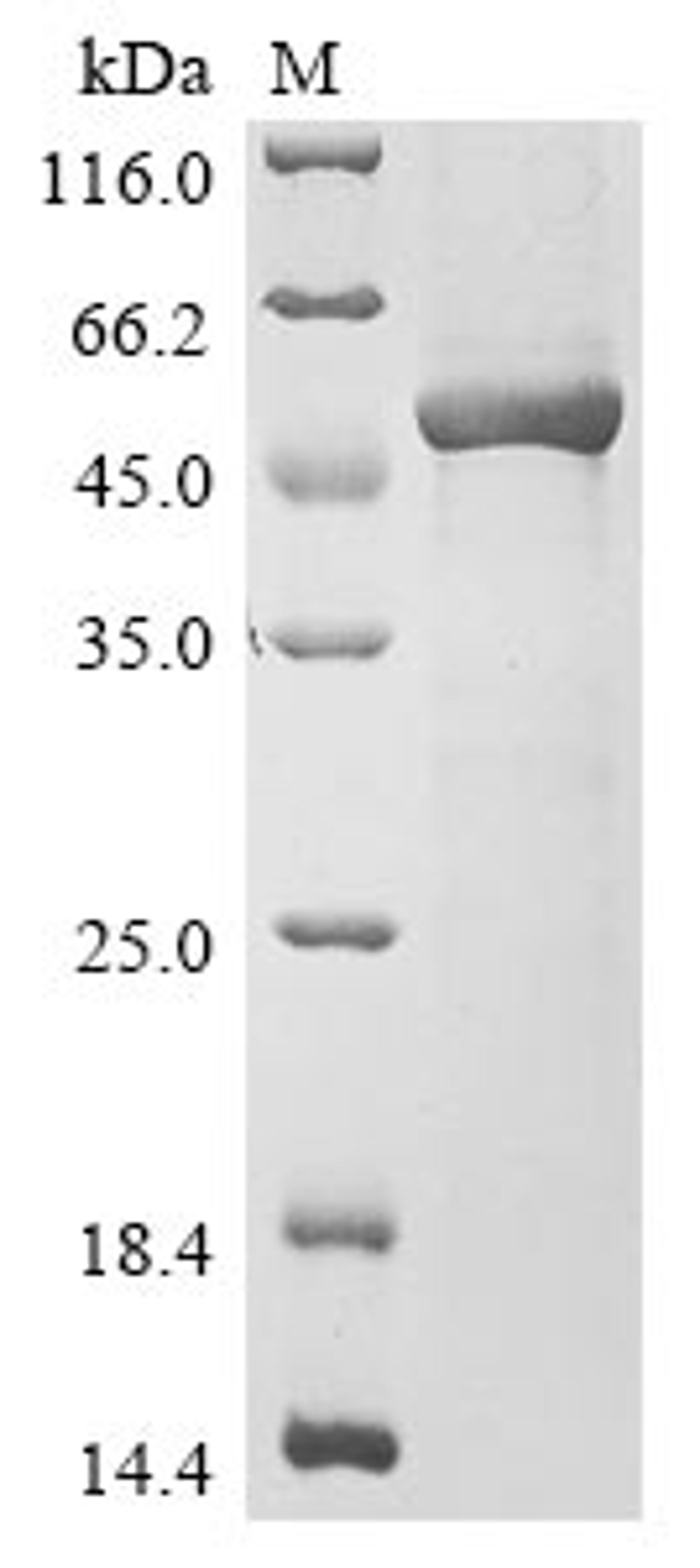 (Tris-Glycine gel) Discontinuous SDS-PAGE (reduced) with 5% enrichment gel and 15% separation gel.