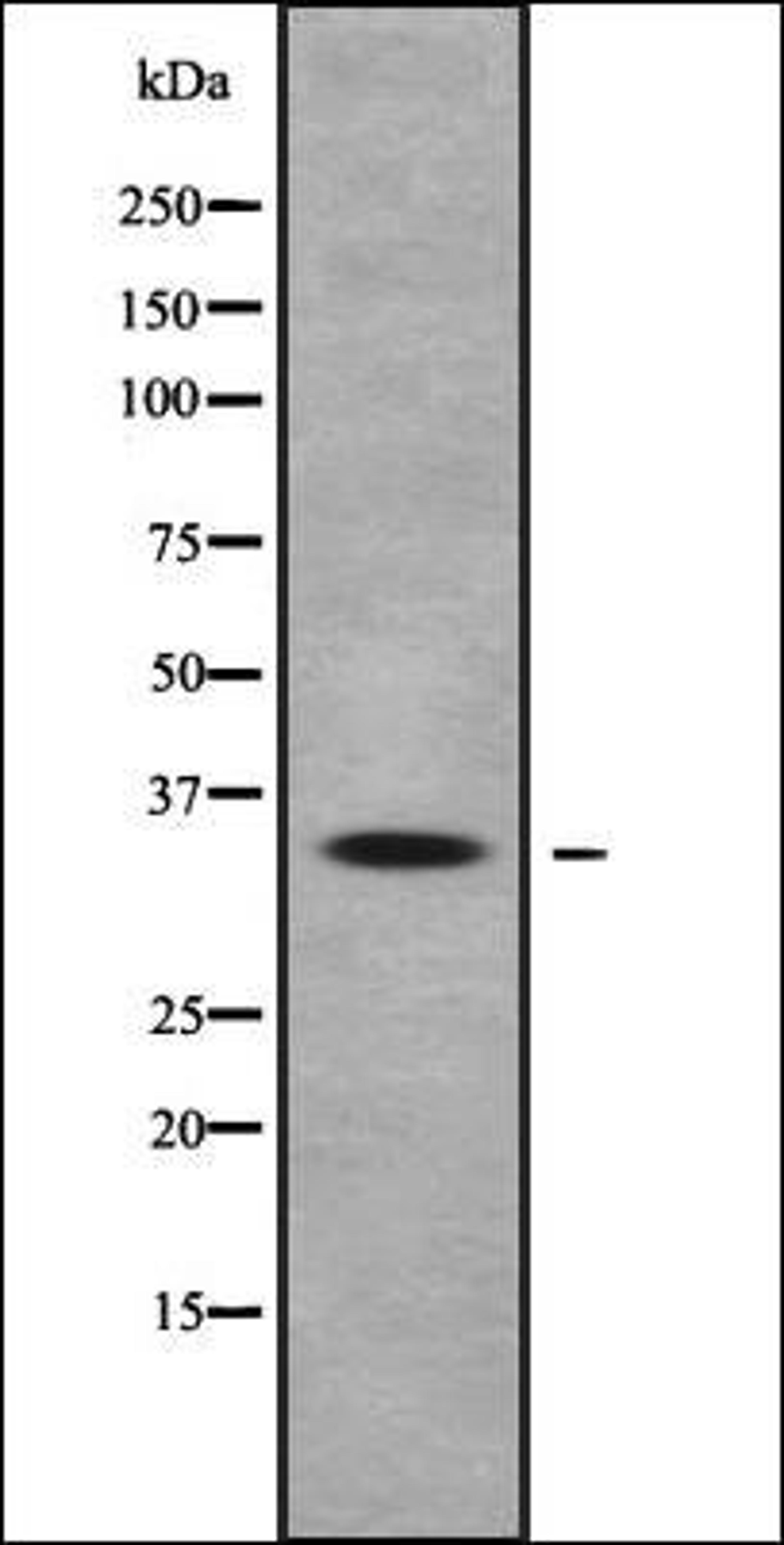 Western blot analysis of HEK293 cells using OR10Q1 antibody