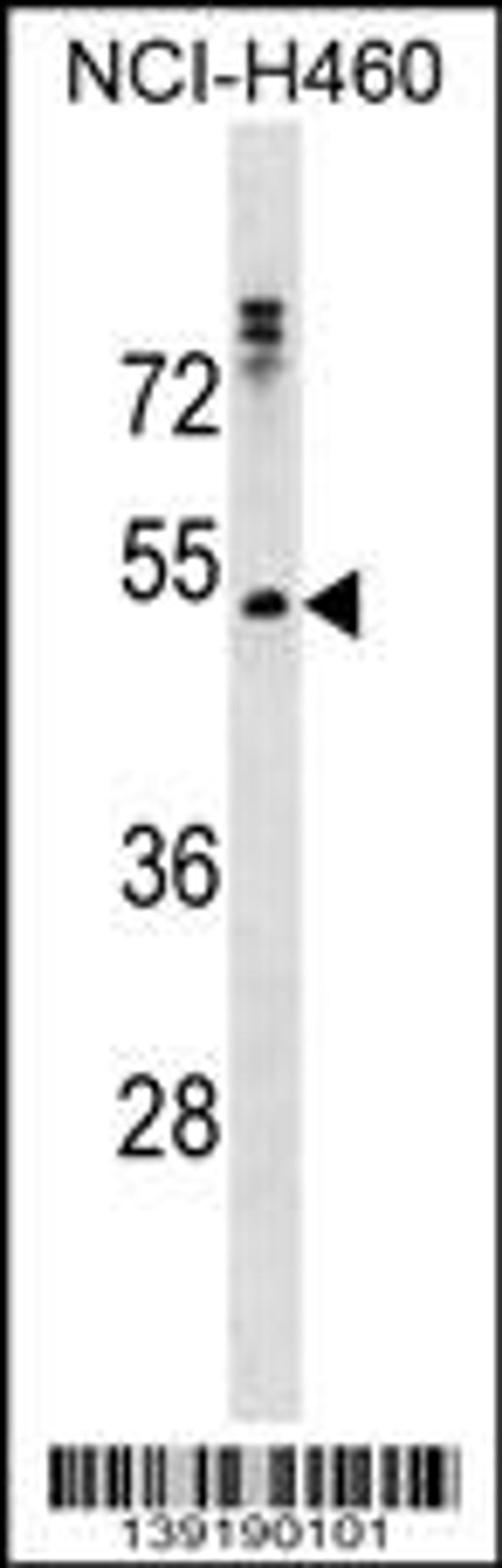 Western blot analysis in NCI-H460 cell line lysates (35ug/lane).