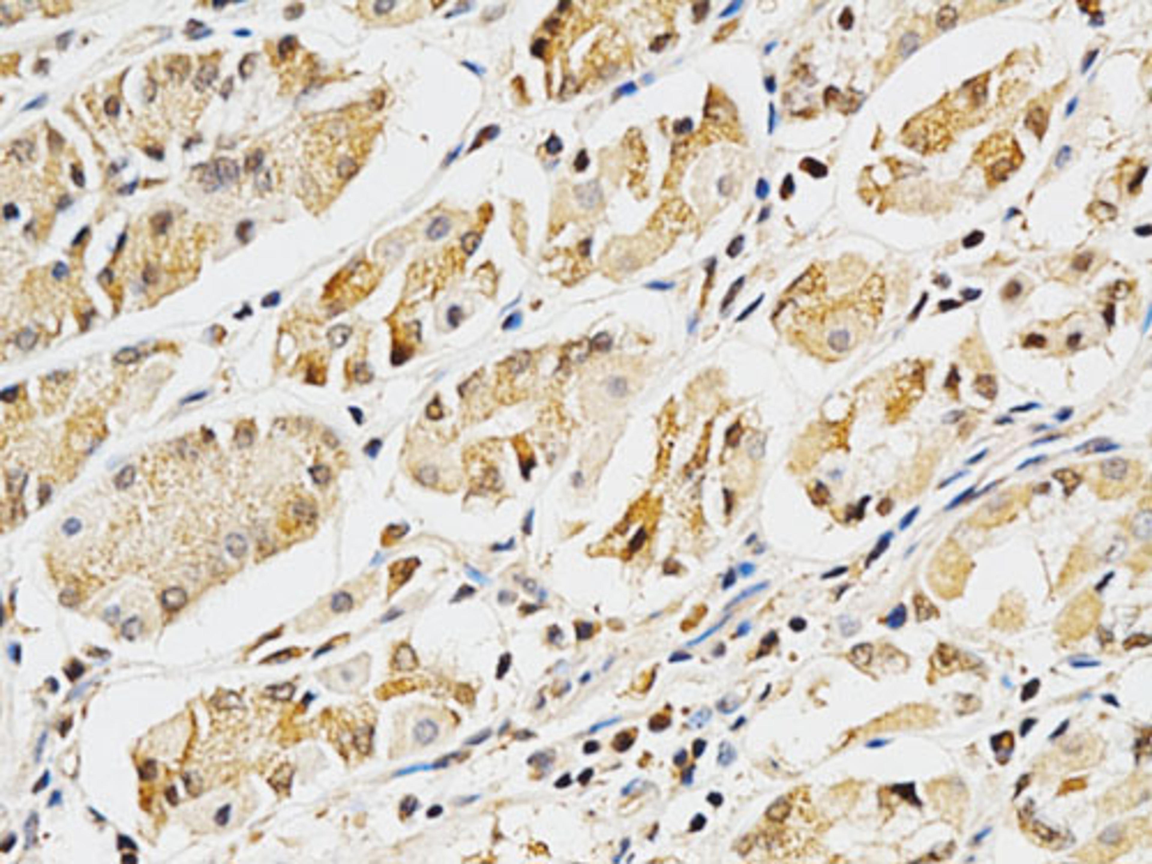 Immunohistochemistry  - LGALS3 Antibody (A1464)