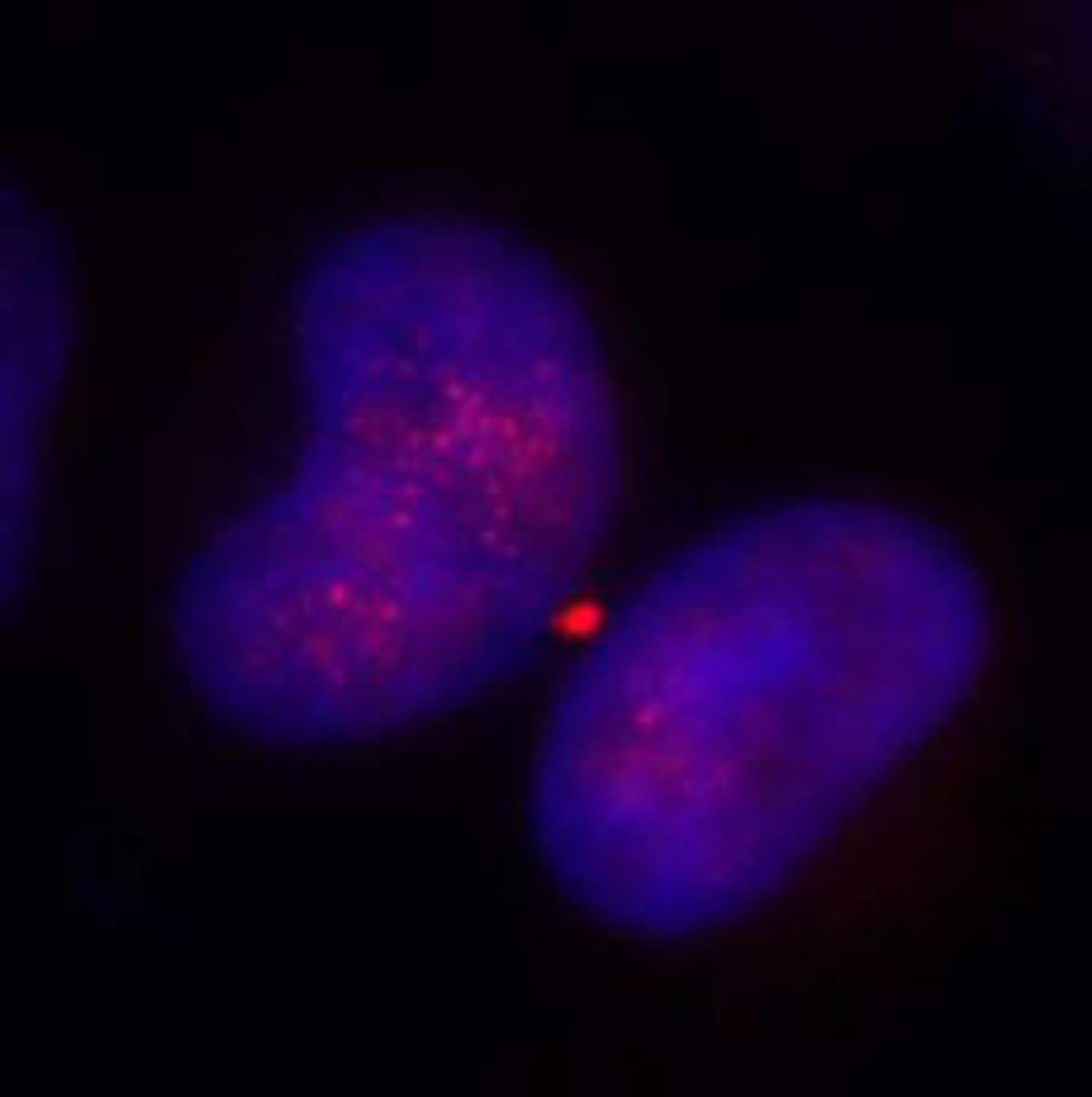 Detection of human KIF14 by immunocytochemistry.