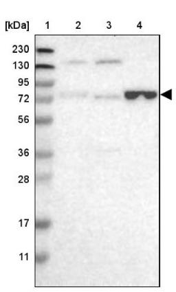 Western Blot: ENTPD4 Antibody [NBP1-81510] - Lane 1: Marker [kDa] 230, 130, 95, 72, 56, 36, 28, 17, 11<br/>Lane 2: Human cell line RT-4<br/>Lane 3: Human cell line U-251MG sp<br/>Lane 4: Human plasma (IgG/HSA depleted)