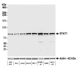 Detection of human STAT1 by western blot.