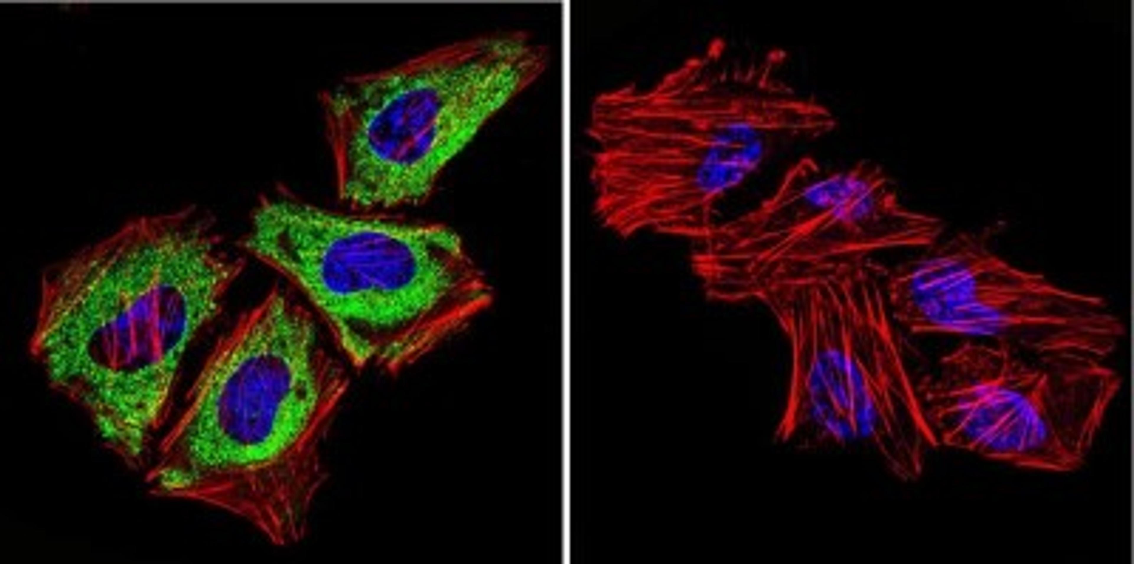 Immunocytochemistry/Immunofluorescence: Cytohesin-1 Antibody (6G11) [NBP2-22513] - Analysis of Cytohesin 1,2 in HeLa Cells. Cells were grown on chamber slides and fixed with formaldehyde prior to staining. Cells were probed without (control) or with a Cytohesin 1,2 monoclonal antibody at a dilution of 1:100 overnight at 4C, washed with PBS and incubated with a DyLight-488 conjugated secondary antibody. Cytohesin 1,2 staining (green), F-Actin staining with Phalloidin (red) and nuclei with DAPI (blue) is shown.