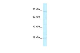 Antibody used in WB on Human Jurkat cells at 2.5 ug/ml.