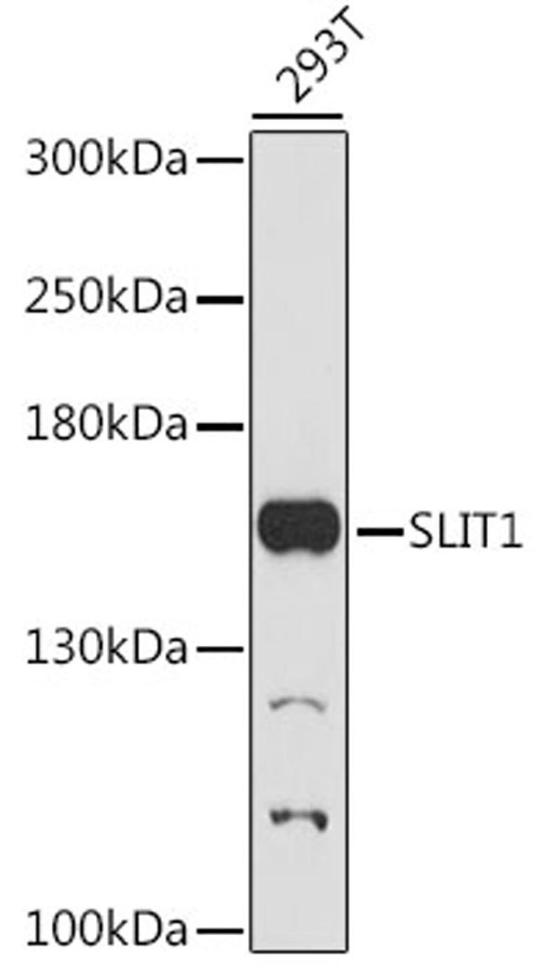 Western blot - SLIT1 antibody (A16430)