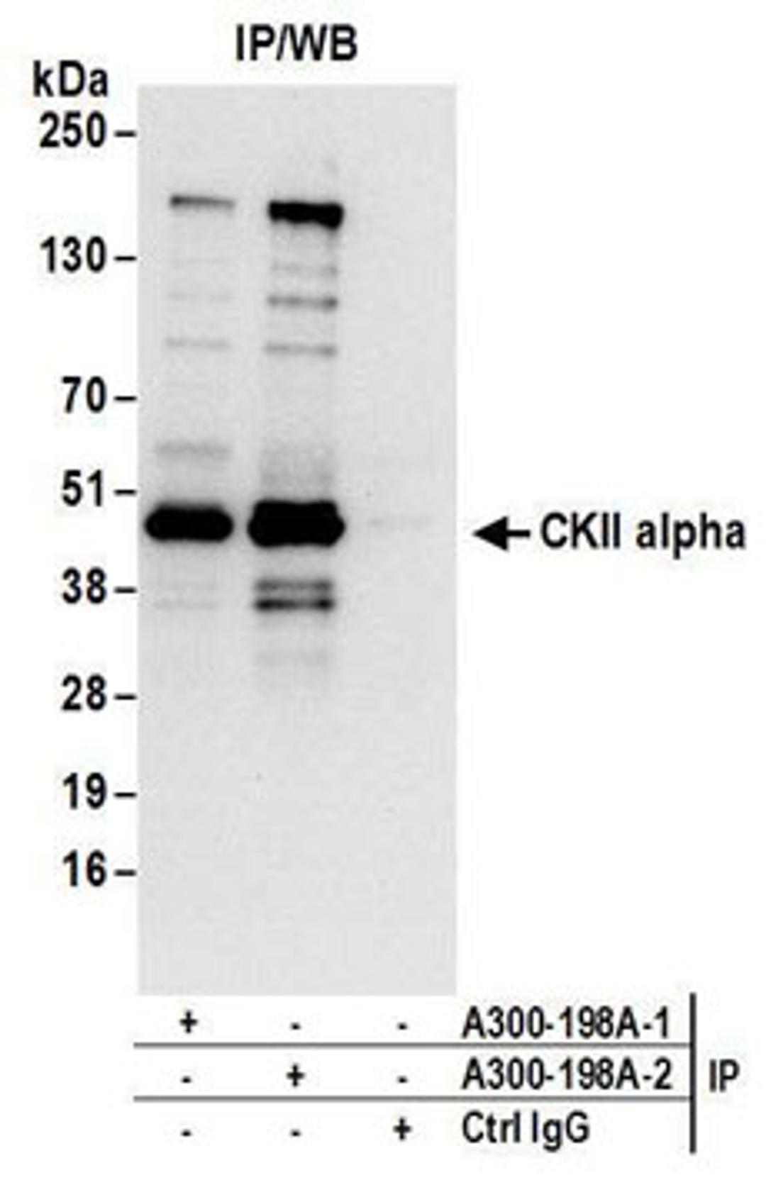 Detection of human CKII alpha by western blot of immunoprecipitates.