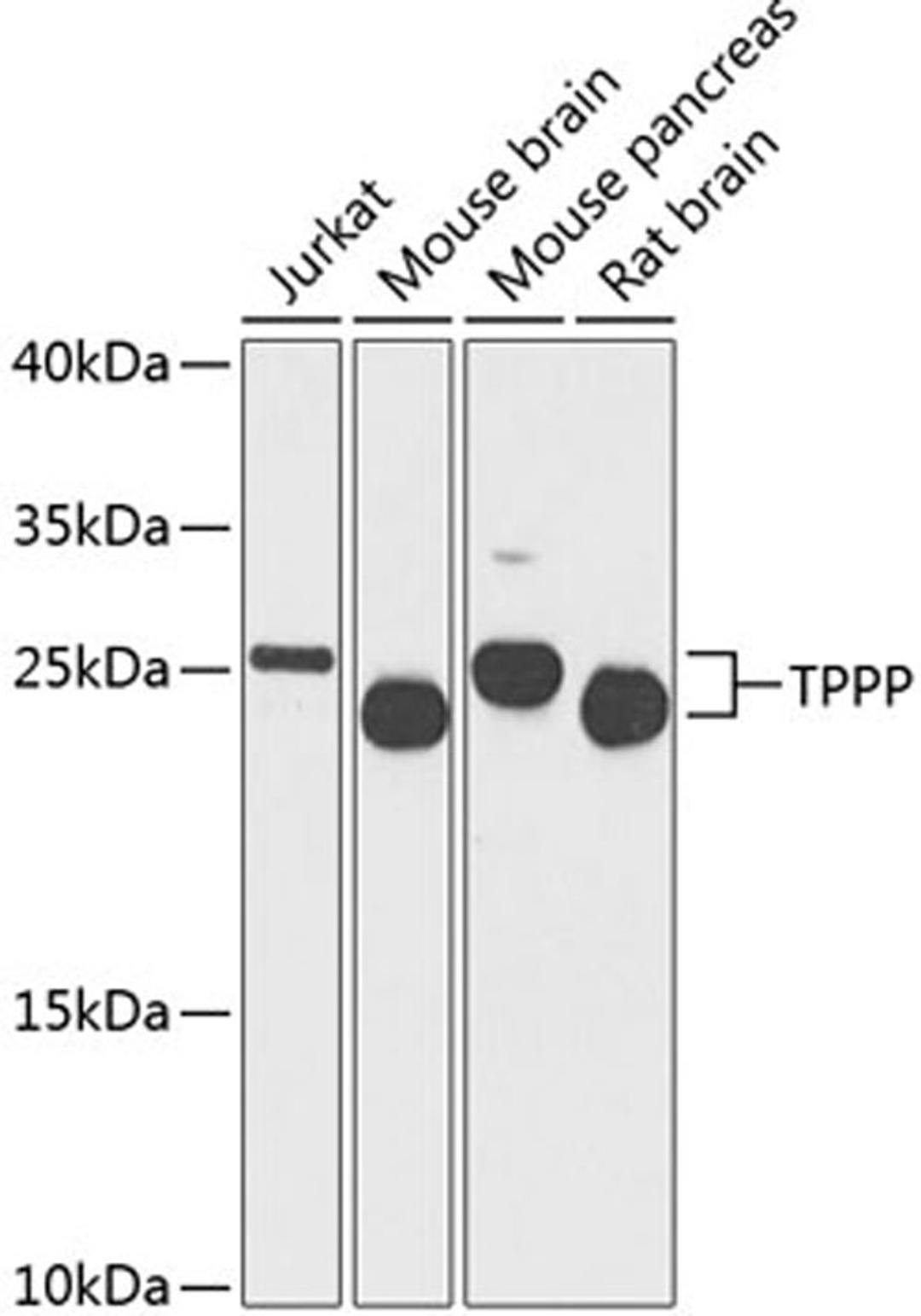 Western blot - TPPP antibody (A8574)